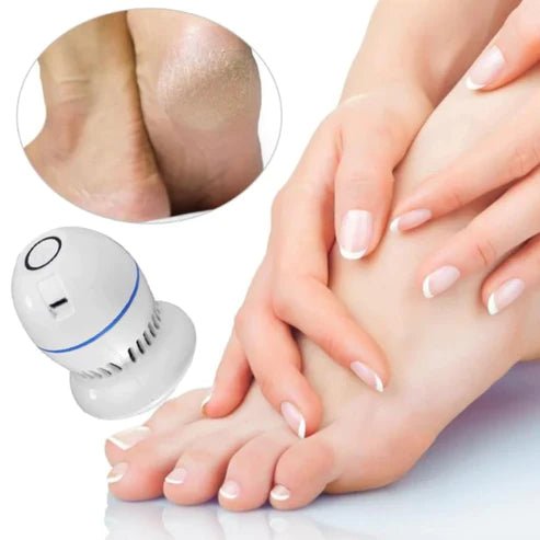 DreamSmooth© Electric Foot Grinder with 3 Sand Stone free - TUNEFRESH